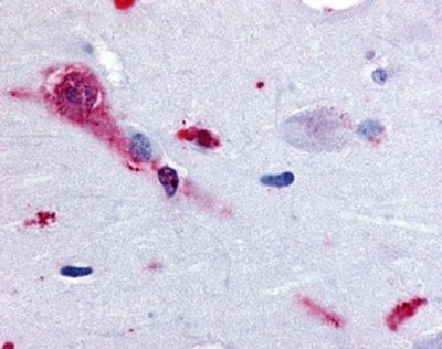 Immunohistochemistry-Paraffin: Trace Amine Receptor 1 Antibody [NB110-55292] - Analysis of anti-TAAR1 antibody with human brain, amygdala at 28 ug/ml.