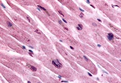 Immunohistochemistry-Paraffin: Muscarinic Acetylcholine Receptor M3/CHRM3 Antibody [NB100-58975] - Analysis of anti-CHRM3 / M3 antibody with human heart at concentration 10 ug/ml.