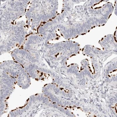 Immunohistochemistry: Leukotriene B4 Receptor 2 Antibody [NBP1-89960] - Staining of human fallopian tube shows distinct positivity in ciliated cells.