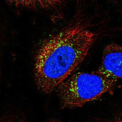 Immunocytochemistry/Immunofluorescence: STK11IP Antibody [NBP2-58347] - Staining of human cell line HeLa shows localization to vesicles.