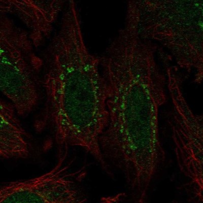 Immunocytochemistry/Immunofluorescence: WDR88 Antibody [NBP2-58333] - Staining of human cell line SiHa shows localization to nucleoplasm & the Golgi apparatus.