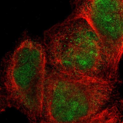 Immunocytochemistry/Immunofluorescence: SIX1 Antibody [NBP1-84264] - Staining of human cell line A-431 shows localization to nucleus & nucleoli.