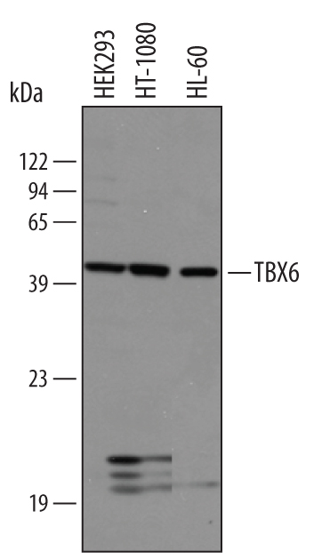 Western blot shows lysates of HEK293 human embryonic kidney cell line, HT1080 human fibrosarcoma cell line, and HL‑60 human acute promyelocytic leukemia cell line. PVDF membrane was probed with 1 µg/mL of Human TBX6 Antigen Affinity-purified Polyclonal Antibody (Catalog # AF4744) followed by HRP-conjugated Anti-Goat IgG Secondary Antibody (Catalog # HAF019). A specific band was detected for TBX6 at approximately 45 kDa (as indicated). This experiment was conducted under reducing conditions and using Immunoblot Buffer Group 8.