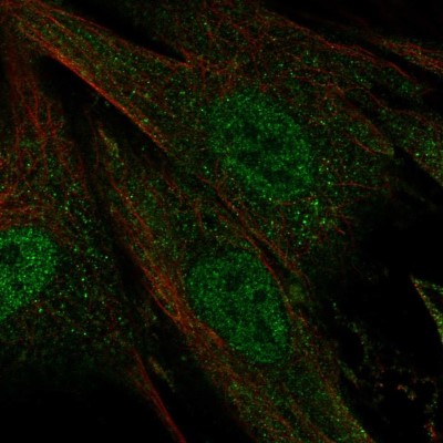 Immunocytochemistry/Immunofluorescence: Ceramide Kinase Like Antibody [NBP2-58304] - Staining of human cell line BJ shows localization to nucleoplasm & cytosol.