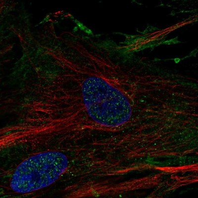 Immunocytochemistry/Immunofluorescence: Elastin Antibody [NBP2-33805] - Staining of human cell line BJ shows localization to plasma membrane.