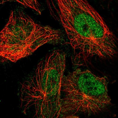 Immunocytochemistry/Immunofluorescence: TRPM7 Antibody [NBP2-58525] - Staining of human cell line U-251 MG shows localization to nucleoplasm.