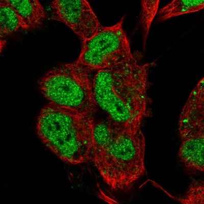 Immunocytochemistry/Immunofluorescence: Islet-1 Antibody [NBP2-33831] - Immunofluorescent staining of human cell line SH-SY5Y shows localization to nucleoplasm.
