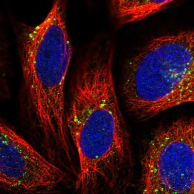 Immunocytochemistry/Immunofluorescence: VPS35 Antibody [NBP2-13517] - Staining of human cell line U-2 OS shows localization to endosomes & lysosomes.