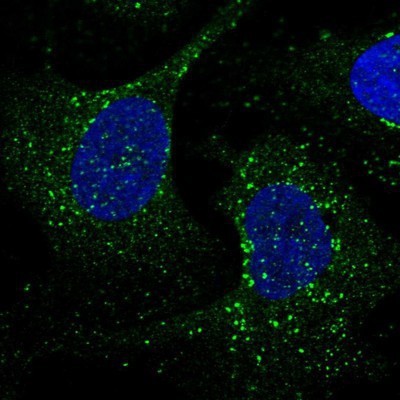 Immunocytochemistry/Immunofluorescence: VPS35 Antibody [NBP2-13517] - Staining of human cell line U-2 OS shows positivity in vesicles.