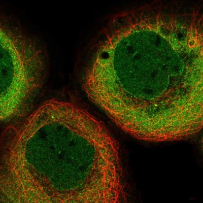 Immunocytochemistry/Immunofluorescence: Importin beta/KPNB1 Antibody [NBP1-87712] - Immunofluorescent staining of human cell line A-431 shows localization to nucleoplasm, nuclear membrane & cytosol.