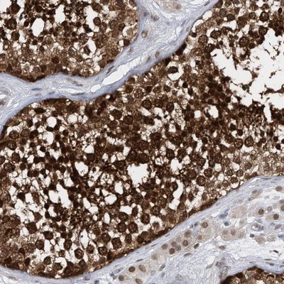 Immunohistochemistry-Paraffin: Importin beta/KPNB1 Antibody [NBP1-87712] - Staining of human testis shows strong nuclear and cytoplasmic positivity in cells in seminiferus ducts.