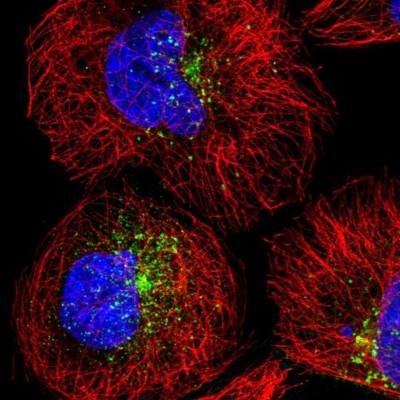 Immunocytochemistry/Immunofluorescence: SNX17 Antibody [NBP1-92417] - Staining of human cell line A-431 shows localization to vesicles.