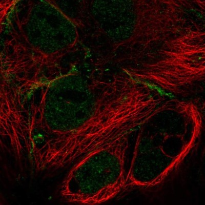 Immunocytochemistry/Immunofluorescence: MPP7 Antibody [NBP2-58527] - Staining of human cell line CACO-2 shows localization to nucleoplasm & cell junctions.