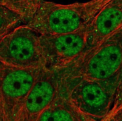 Immunocytochemistry/Immunofluorescence: TET3 Antibody [NBP2-13427] - Staining of human cell line MCF7 shows localization to nucleoplasm, cytosol & vesicles. Antibody staining is shown in green.