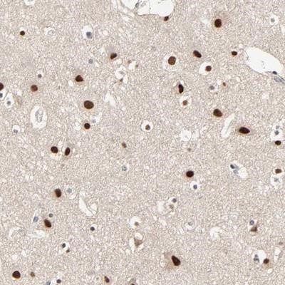 Immunohistochemistry-Paraffin: 5HT1E Receptor Antibody [NBP1-90320] - Staining of human cerebral cortex shows strong nuclear positivity in neuronal cells.