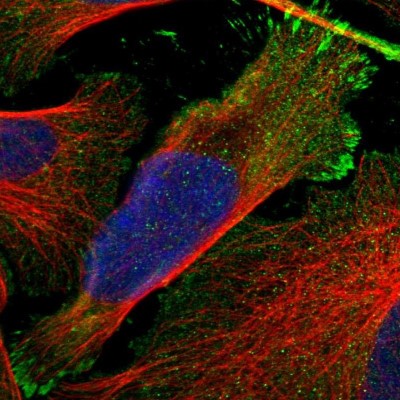 Immunocytochemistry/Immunofluorescence: RASAL2 Antibody [NBP1-82579] - Immunofluorescent staining of human cell line U-2 OS shows localization to plasma membrane & focal adhesion sites.