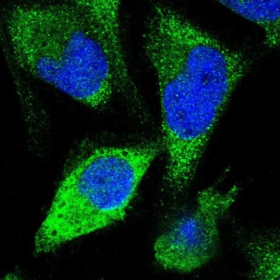 Immunocytochemistry/Immunofluorescence: FGF-13 Antibody [NBP1-84689] - Immunofluorescent staining of human cell line U-2 OS shows localization to cytosol.