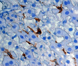 CLEC4F/CLECSF13 was detected in perfusion fixed frozen sections of mouse liver using Goat Anti-Mouse CLEC4F/CLECSF13 Antigen Affinity-purified Polyclonal Antibody (Catalog # AF2784) at 5 µg/mL overnight at 4 °C. Tissue was stained using the Anti-Goat HRP-DAB Cell & Tissue Staining Kit (brown; Catalog # CTS008) and counterstained with hematoxylin (blue). Specific staining was localized to Kupffer cells. View our protocol for Chromogenic IHC Staining of Frozen Tissue Sections.