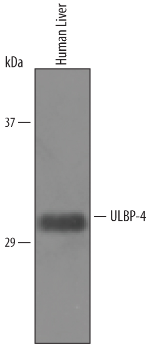 Western blot shows lysates of human liver tissue. PVDF Membrane was probed with 2 µg/mL of Goat Anti-Human ULBP‑4/RAET1E Antigen Affinity-purified Polyclonal Antibody (Catalog # AF6285) followed by HRP-conjugated Anti-Goat IgG Secondary Antibody (Catalog # HAF019). A specific band was detected for ULBP‑4/RAET1E at approximately 32 kDa (as indicated). This experiment was conducted under reducing conditions and using Immunoblot Buffer Group 8.