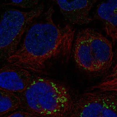 Immunocytochemistry/Immunofluorescence: B4GALNT3 Antibody [NBP1-90836] - Staining of human cell line CACO-2 shows localization to the Golgi apparatus & vesicles.