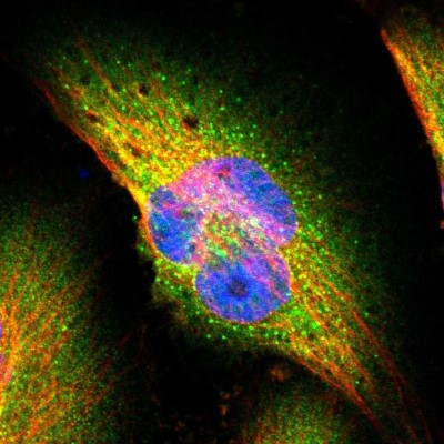 Immunocytochemistry/Immunofluorescence: SEC31A Antibody [NBP1-89301] - Immunofluorescent staining of human cell line U-251 MG shows localization to cytosol & vesicles.