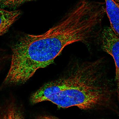 Immunocytochemistry/Immunofluorescence: Synaptobrevin homolog YKT6 Antibody [NBP1-90344] - Immunofluorescent staining of human cell line U-2 OS shows localization to cytosol.
