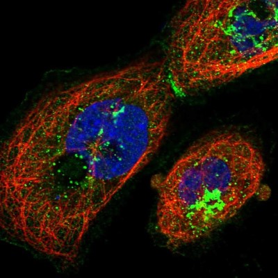 Immunocytochemistry/Immunofluorescence: ABCA7 Antibody [NBP2-14250] - Immunofluorescent staining of human cell line A-431 shows localization to plasma membrane, the Golgi apparatus & cell junctions.