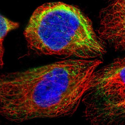 Immunocytochemistry/Immunofluorescence: TM6SF1 Antibody [NBP1-91091] - Immunofluorescent staining of human cell line A-431 shows localization to intermediate filaments.