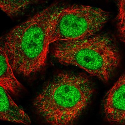 Immunocytochemistry/Immunofluorescence: Nope Antibody [NBP1-92195] - Staining of human cell line A549 shows localization to nucleoplasm & cytosol.