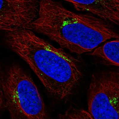 Immunocytochemistry/Immunofluorescence: KIAA0319L Antibody [NBP2-57263] - Staining of human cell line U-2 OS shows localization to the Golgi apparatus.
