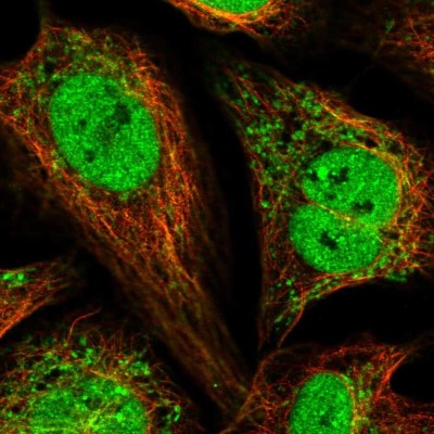 Immunocytochemistry/Immunofluorescence: Magmas Antibody [NBP2-57408] - Staining of human cell line U-2 OS shows localization to nucleoplasm, mitochondria & microtubules.