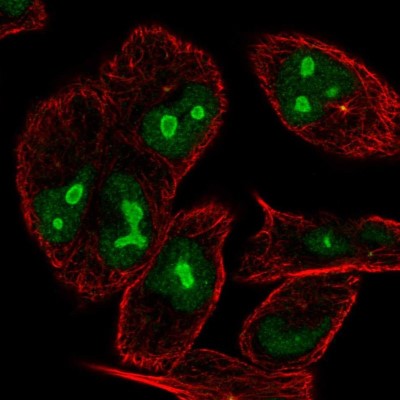 Immunocytochemistry/Immunofluorescence: Ninein Antibody [NBP2-57419] - Staining of human cell line RT4 shows localization to nucleus, nucleoli & centrosome.