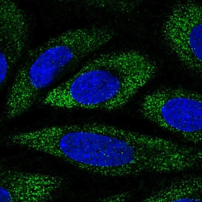 Immunocytochemistry/Immunofluorescence: ANKH Antibody [NBP2-57383] - Staining of human cell line SiHa shows localization to cytosol.