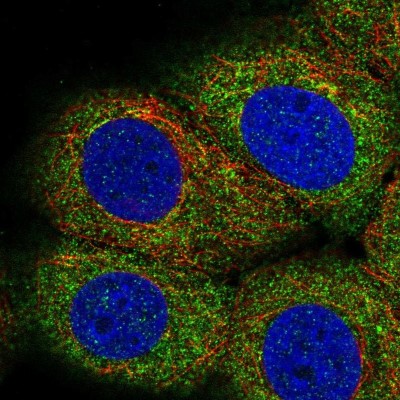 Immunocytochemistry/Immunofluorescence: Lipin 3 Antibody [NBP2-57319] - Staining of human cell line MCF7 shows localization to cytosol.
