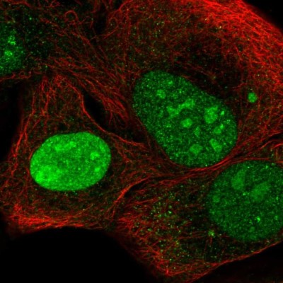 Immunocytochemistry/Immunofluorescence: C3orf17 Antibody [NBP2-57440] - Staining of human cell line HaCaT shows localization to nucleus & nucleoli.