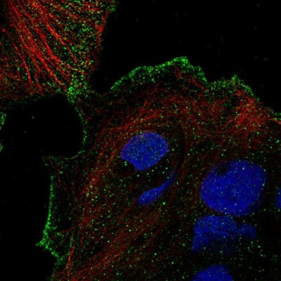 Immunocytochemistry/Immunofluorescence: Vanilloid R-like 3/TRPV3 Antibody [NBP2-57314] - Staining of human cell line CACO-2 shows localization to plasma membrane.