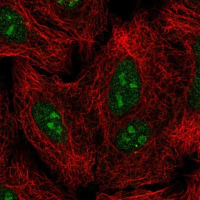 Immunocytochemistry/Immunofluorescence: GLI-2 Antibody [NBP2-57535] - Staining of human cell line A549 shows localization to nucleus & nucleoli.