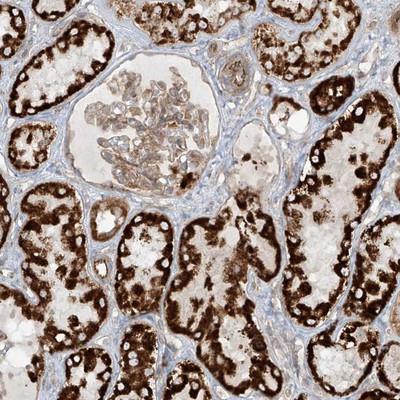 Immunohistochemistry: Eukaryotic translation initiation factor 5B Antibody [NBP1-85120] - Staining of human kidney shows strong cytoplasmic positivity in tubule cells.