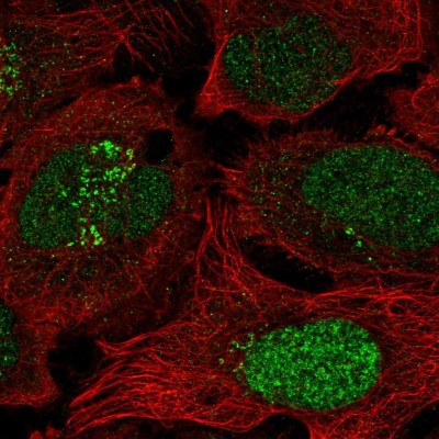 Immunocytochemistry/Immunofluorescence: ESCO2 Antibody [NBP2-58532] - Staining of human cell line U-2 OS shows localization to nucleus & the Golgi apparatus.
