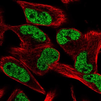 Immunocytochemistry/Immunofluorescence: C20orf160 Antibody [NBP2-58827] - Staining of human cell line RH-30 shows localization to nucleoplasm.