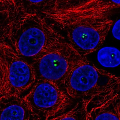 Immunocytochemistry/Immunofluorescence: Coilin Antibody [NBP2-58668] - Staining of human cell line MCF7 shows localization to nucleoli fibrillar center.