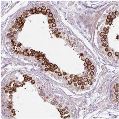 Immunohistochemistry: CXorf30 Antibody [NBP2-30729] - Staining of human testis shows strong cytoplasmic positivity in cells in seminiferus ducts.