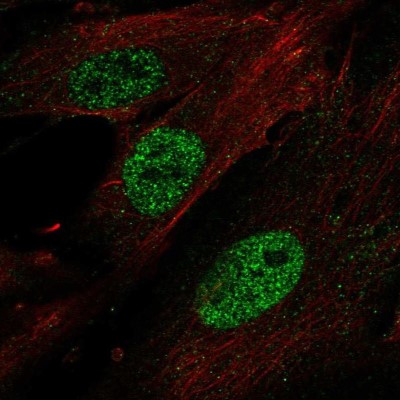 Immunocytochemistry/Immunofluorescence: HOXA11 Antibody [NBP2-58894] - Staining of human cell line BJ shows localization to nucleoplasm.