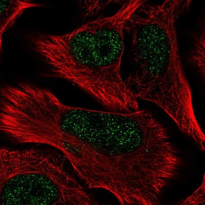 Immunocytochemistry/Immunofluorescence: CREB3 regulatory factor Antibody [NBP2-58759] - Staining of human cell line SK-MEL-30 shows localization to nucleoplasm.
