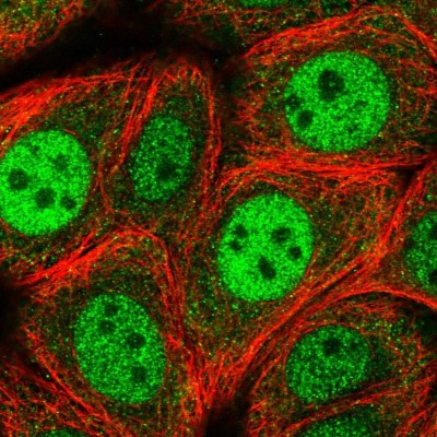Immunocytochemistry/Immunofluorescence: RGS3 Antibody [NBP2-58942] - Staining of human cell line MCF7 shows localization to nucleoplasm & cytosol.