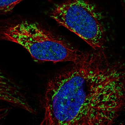 Immunocytochemistry/Immunofluorescence: RIMS3 Antibody [NBP2-58519] - Staining of human cell line U-2 OS shows localization to nucleus, nucleoli & mitochondria.