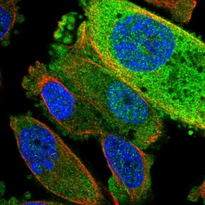 Immunocytochemistry/Immunofluorescence: TRUB2 Antibody [NBP2-58583] - Staining of human cell line PC-3 shows localization to cytosol.