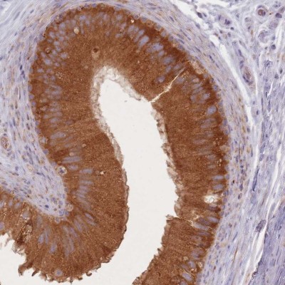 Immunohistochemistry-Paraffin: C4orf34 Antibody [NBP2-14413] - Staining of human epididymis shows cytoplasmic positivity in glandular cells.