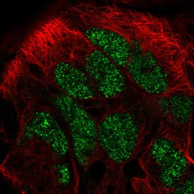 Immunocytochemistry/Immunofluorescence: calmodulin-lysine N-methyltransferase Antibody [NBP2-57496] - Staining of human cell line CACO-2 shows localization to nucleus.