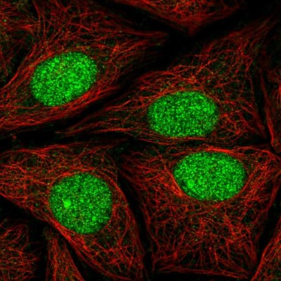 Immunocytochemistry/Immunofluorescence: ATXN1L Antibody [NBP2-57478] - Staining of human cell line SiHa shows localization to nucleus.